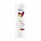 Dove Intense Care testápoló nagyon száraz bőrre 400 ml